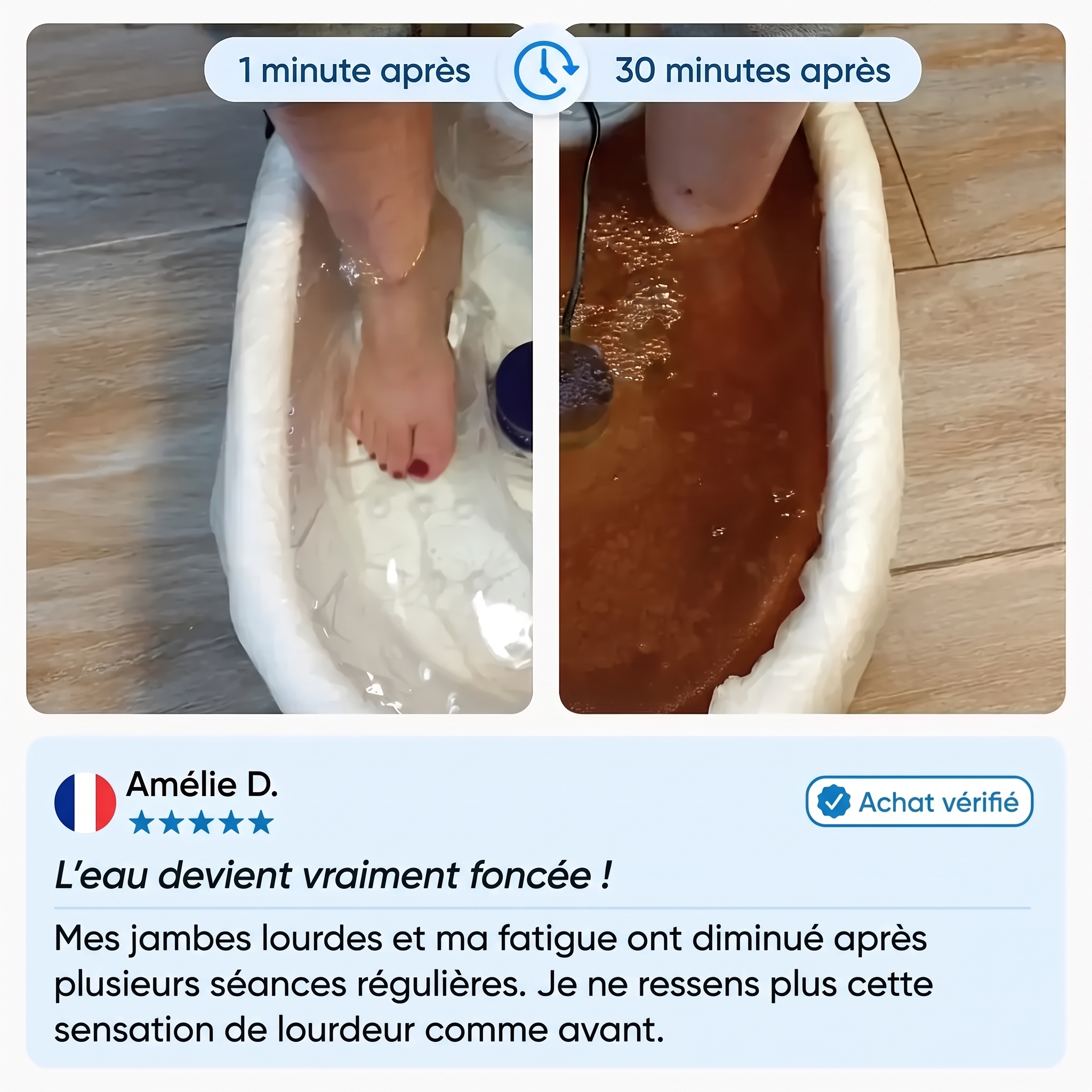 Kalvona témoignage Amélie eau foncée