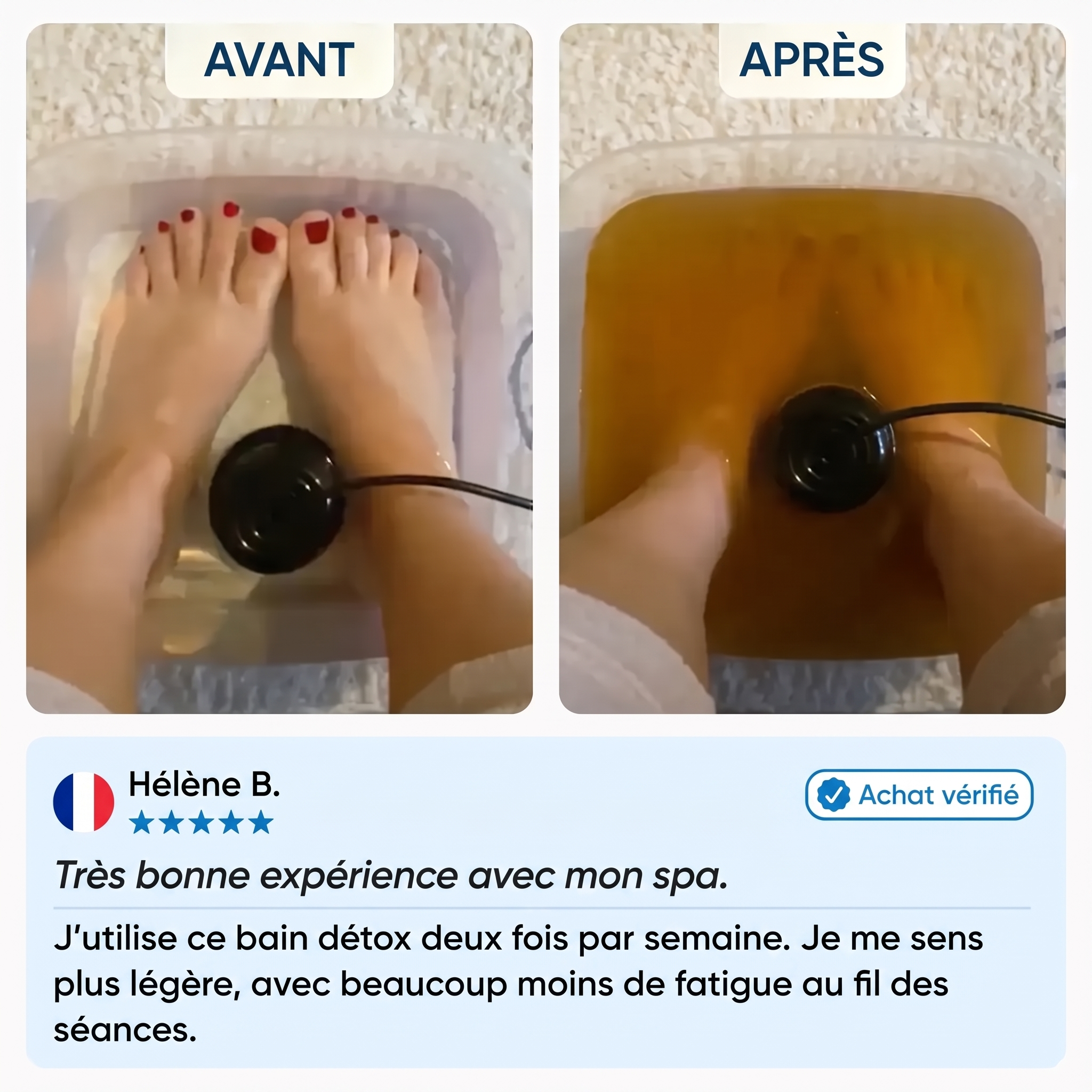 Kalvona témoignage Hélène avant après
