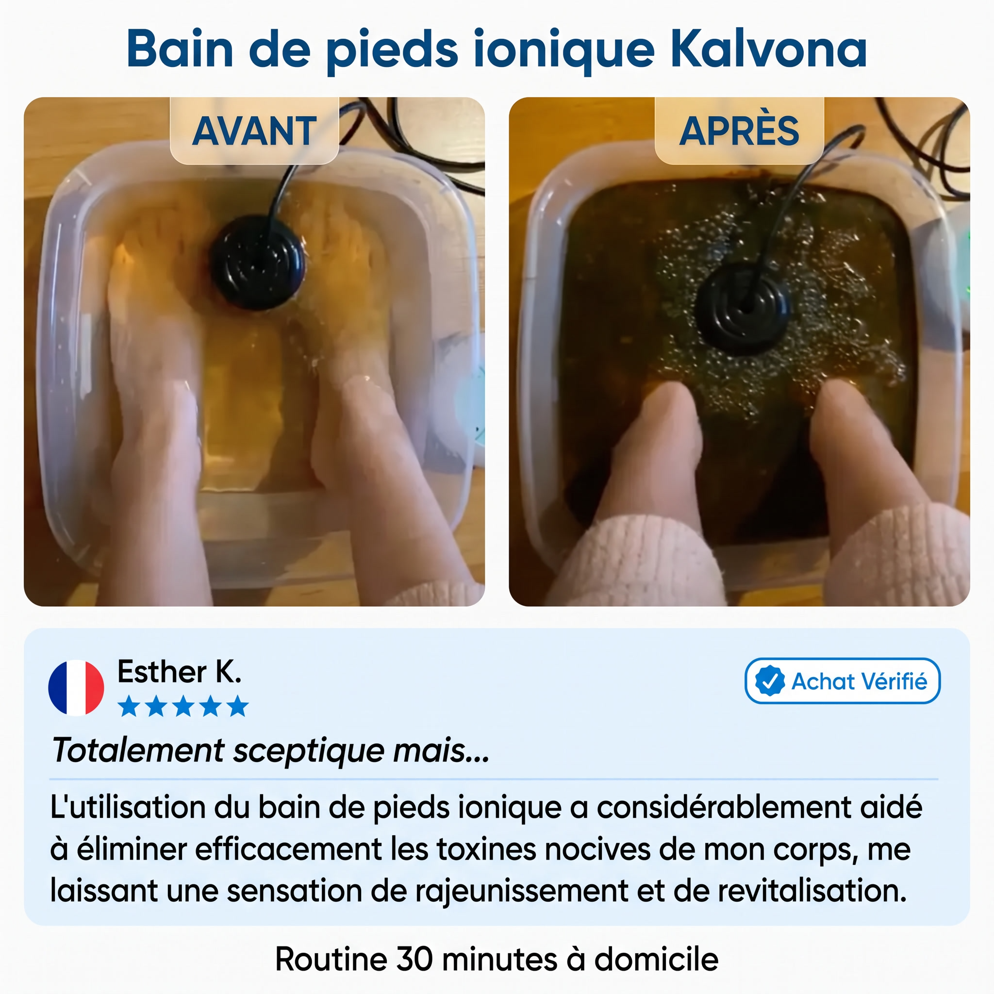 Kalvona visuel device2