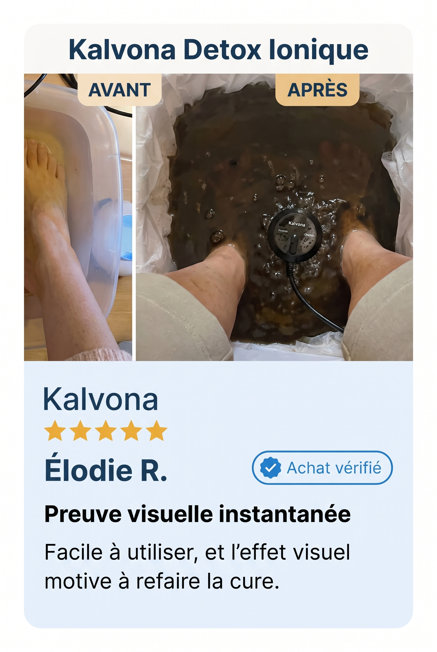 Élodie R. — Achat vérifié Kalvona Bain de Pieds Ionique